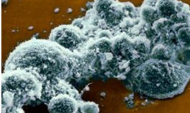 Цветной микроснимок сканирующего электронного микроскопа клеток фибробластов 