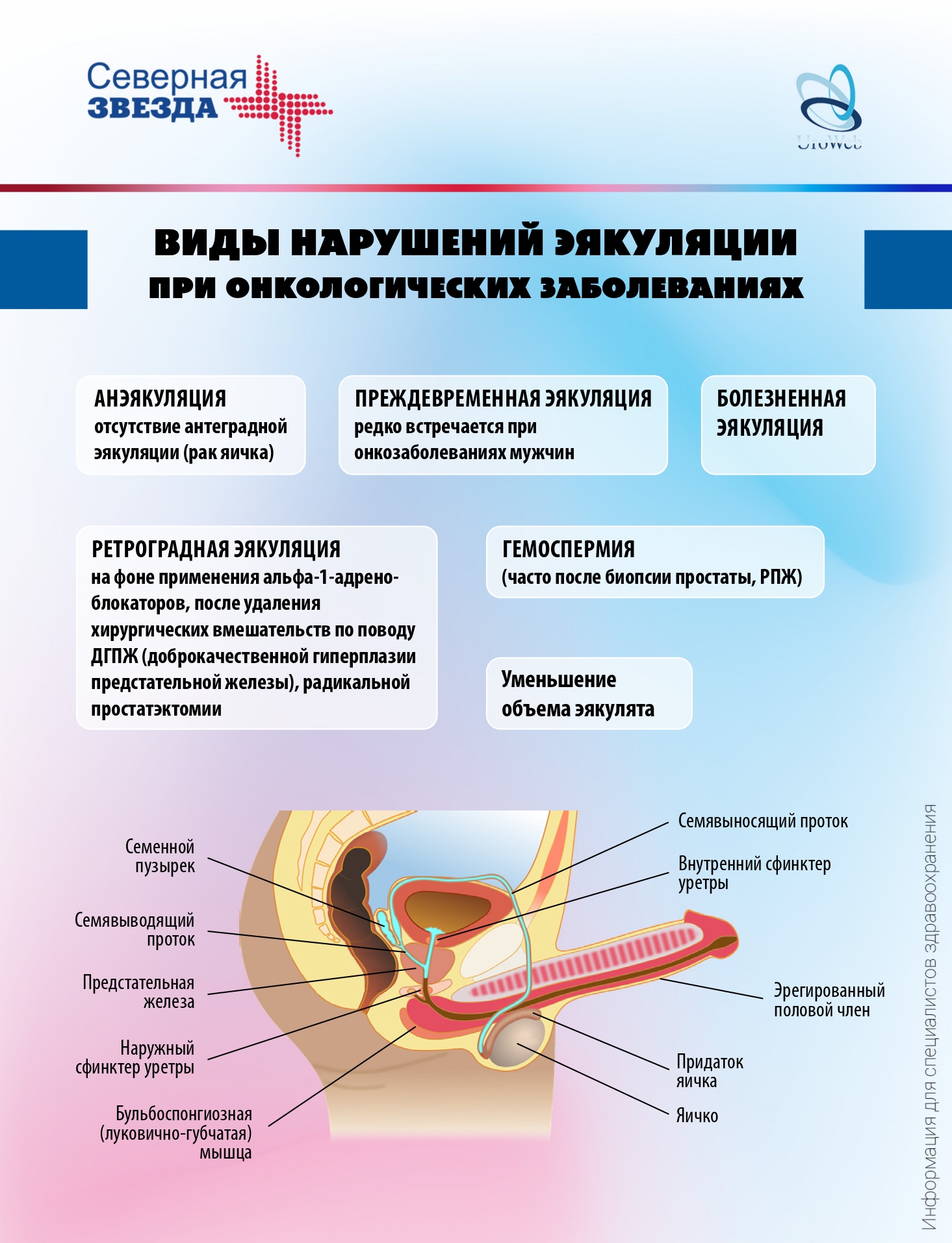 Нарушения эякуляции у онкологических пациентов