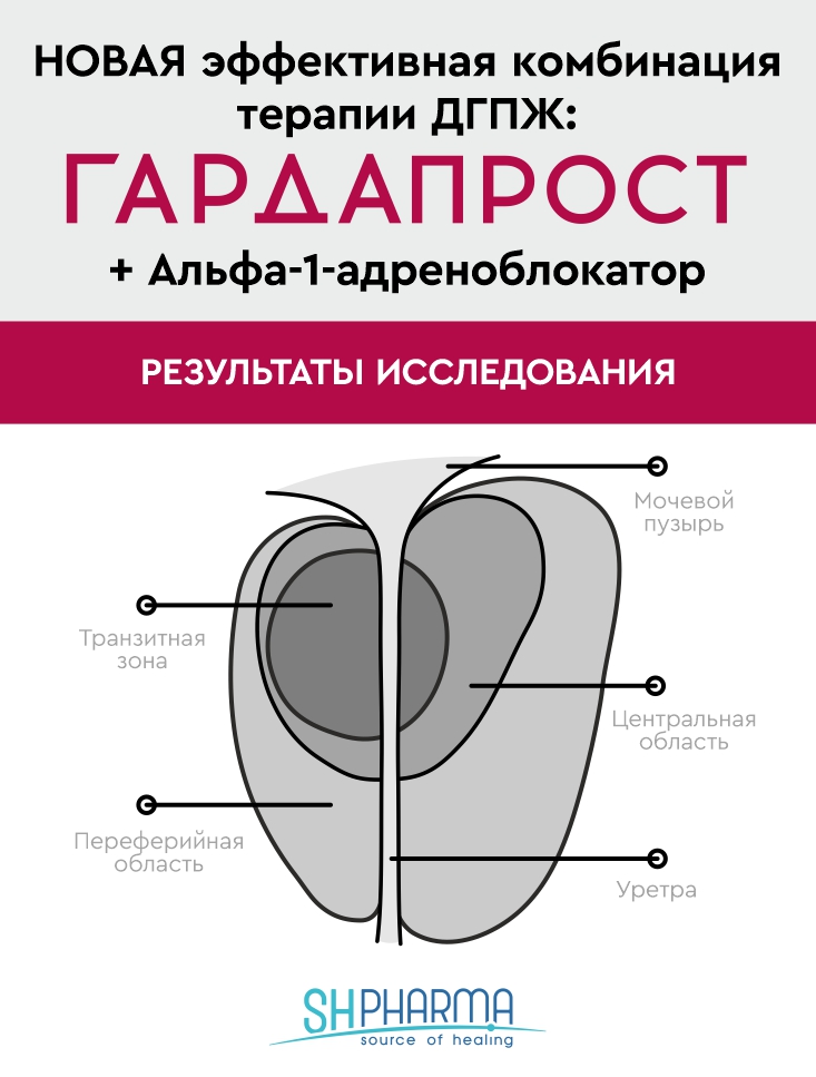 НОВАЯ эффективная комбинация терапии ДГПЖ: ГАРДАПРОСТ +  Alfa-1-адреноблокатор. Результаты исследования