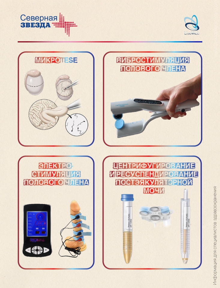 Преодоление бесплодия при нарушениях эякуляции