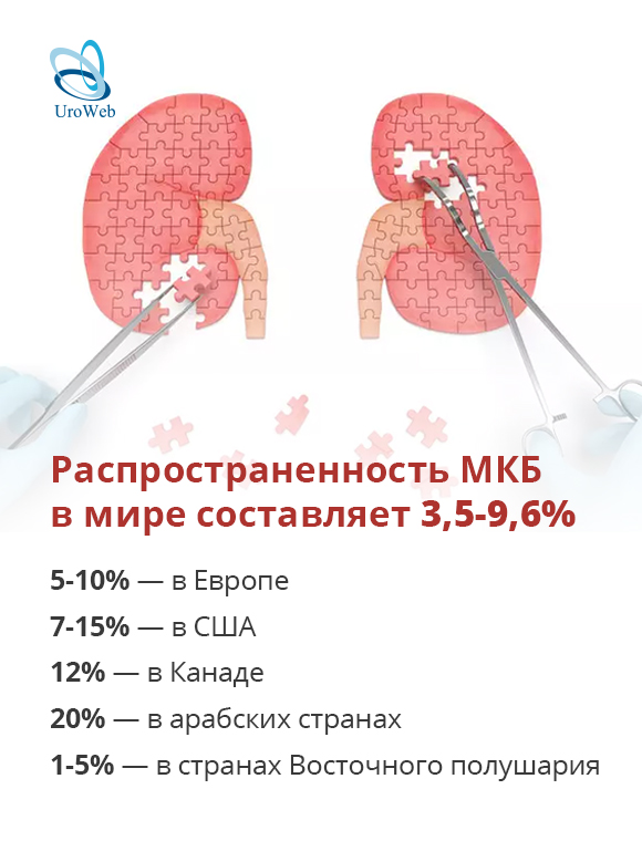 МКБ в мире и в России