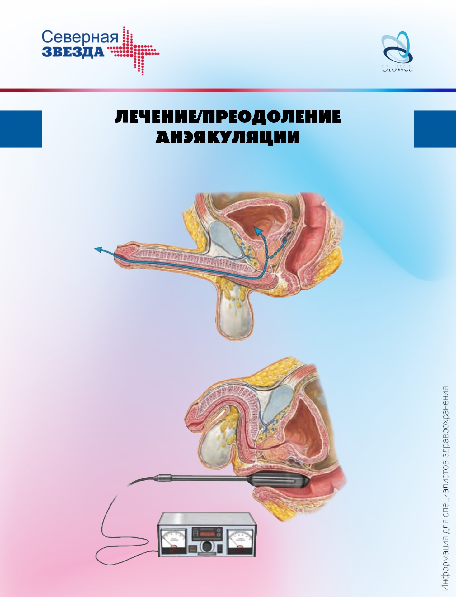 Нарушения эякуляции у онкологических пациентов