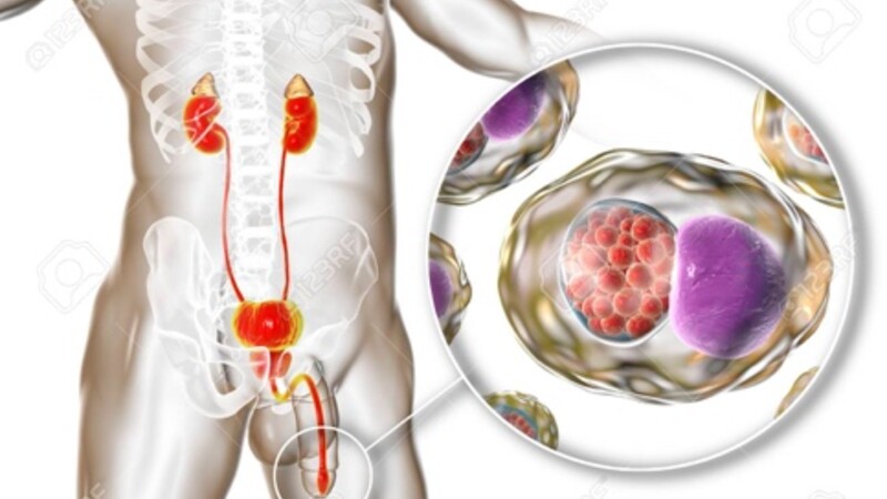 Хламидийная инфекция (Chlamydia trachomatis) в урологии