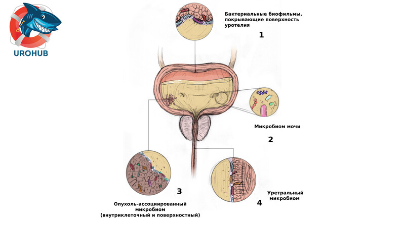 Микробиота мочи и рак мочевого пузыря: акцент на уропатогены