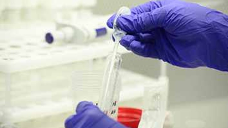 Интерпретация спермограммы