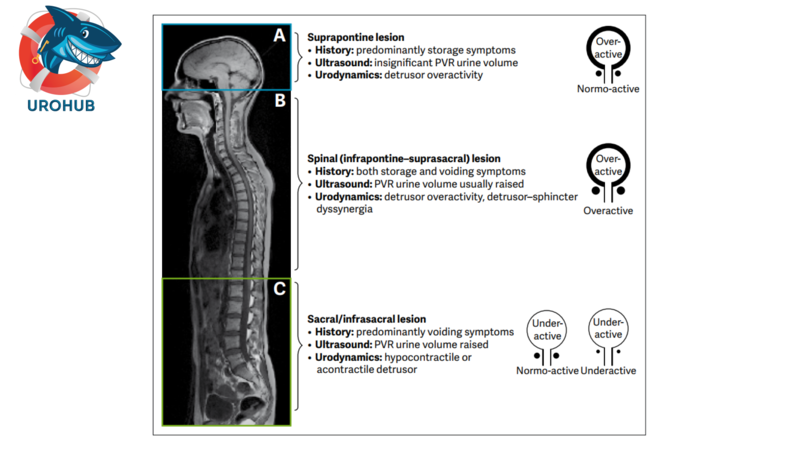 Клинические рекомендации ЕАУ по нейроурологии 2022 г.