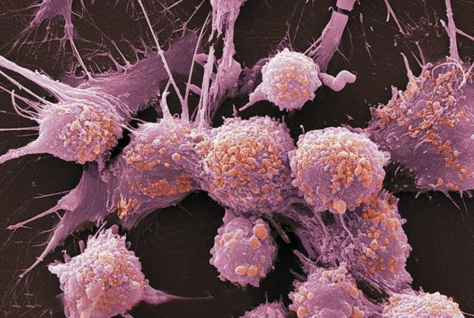 Рак предстательной железы у больных с BRCA в анамнезе