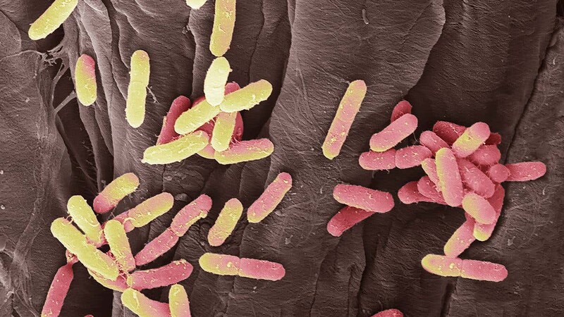 Бактериальный состав мочи у пациентов с мочекаменной болезнью имеет гендерные различия