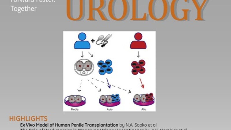 Ex vivo модель трансплантации и отторжения человеческого пениса: последствия для физиологии эректильной ткани