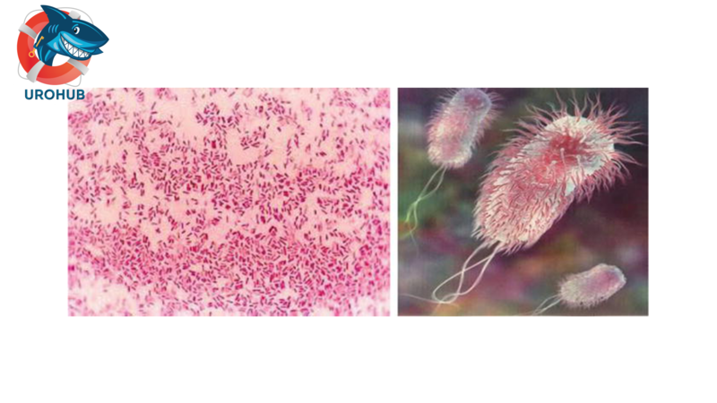 Постоянный катетер и периодическая катетеризация: есть ли разница в предрасположенности к ИМП?