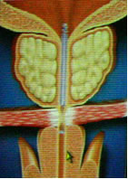 ������� ��������� ������������ ������