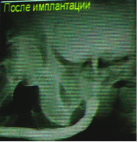 ������� ��������� ������������ ������. ����� �����������