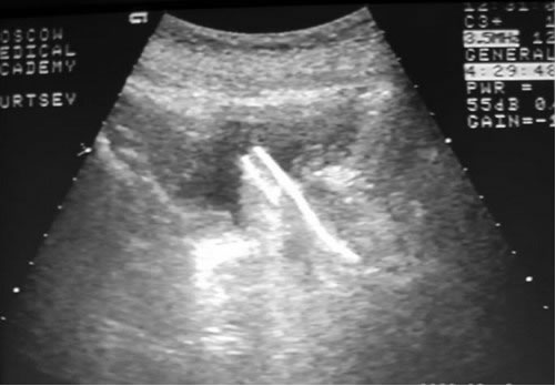 �������� ������������ ������� �� �������������� � ��� �������������� �������� ��������������� ����� ���������