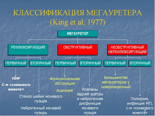 классификация мегауретеров