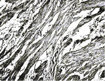 7 сутки (Отек интерстиция, очаговая гиперплазия уротелия)