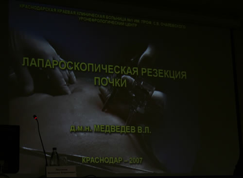 Лапароскопическая резекция почки