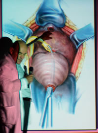 ��������� ��������, ����� ��������, ����� ������, ��������