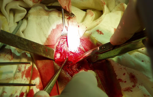 Уретра взята на резиновую держалку