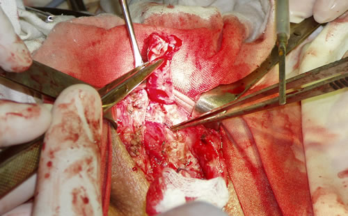 Дистальный конец уретры