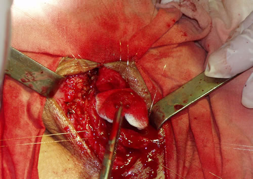 Швы наложены