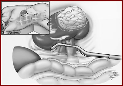 ����� ����������