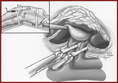 ����� ���� ��������