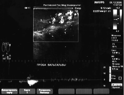           2,2 ,     2,8 ,    3,2 