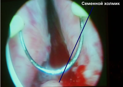    .    ( 6- ),       ,  .