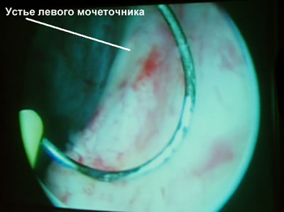   .        ,            .        ( 5- ),    ,  .