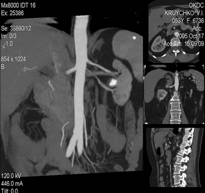    () -  :  7040 ,  12 ,   -  ,        6 .