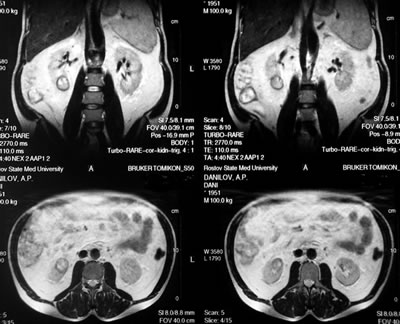 -  () -  :      32 ,      ;       13  19 