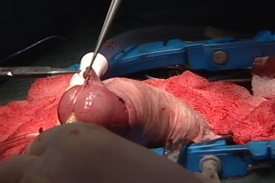 Листки полового члена сведены и готовы к наложению швов