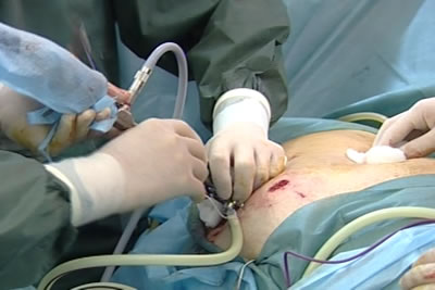 Установка портов