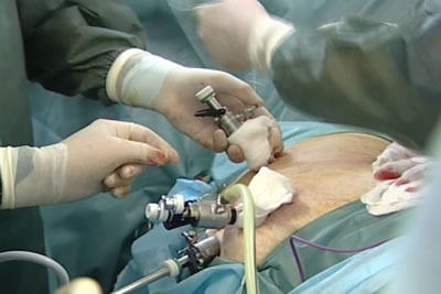 Окончательный вид с установленными портами