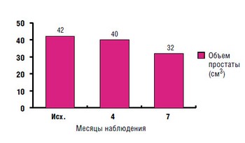 Показатели объема простаты у пациентов 2-й группы