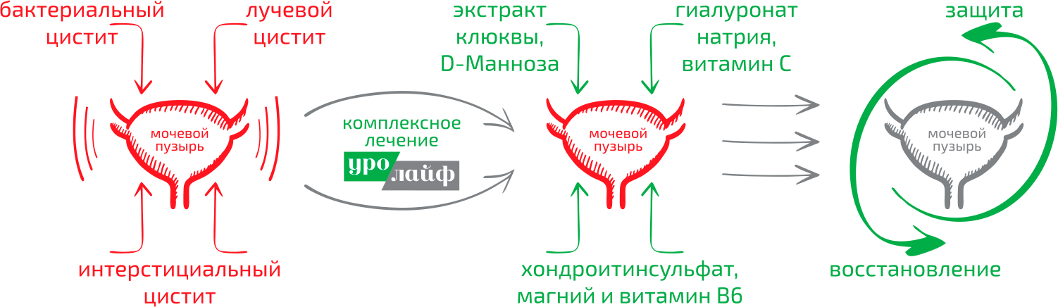 Схемы терапии цистита. Схема лечения интерстициального цистита.